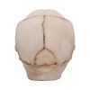 Eyes Wide Open (Pink) Decorative Resin Skull